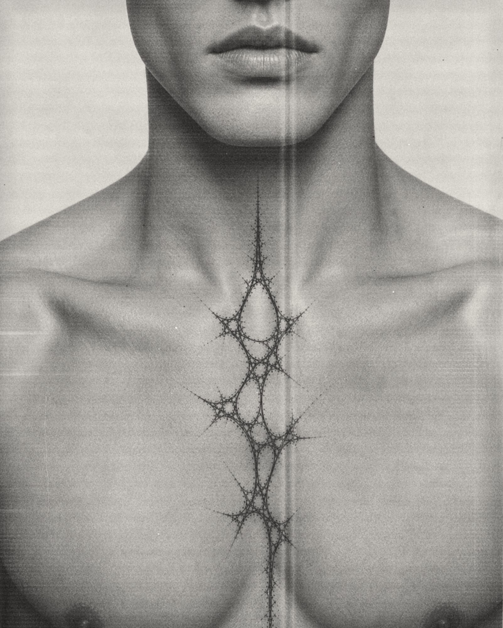 MT004 Spine worn — Sternum